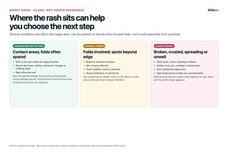 Nappy rash clue chart comparing irritant rash, possible thrush and rashes needing clinical review